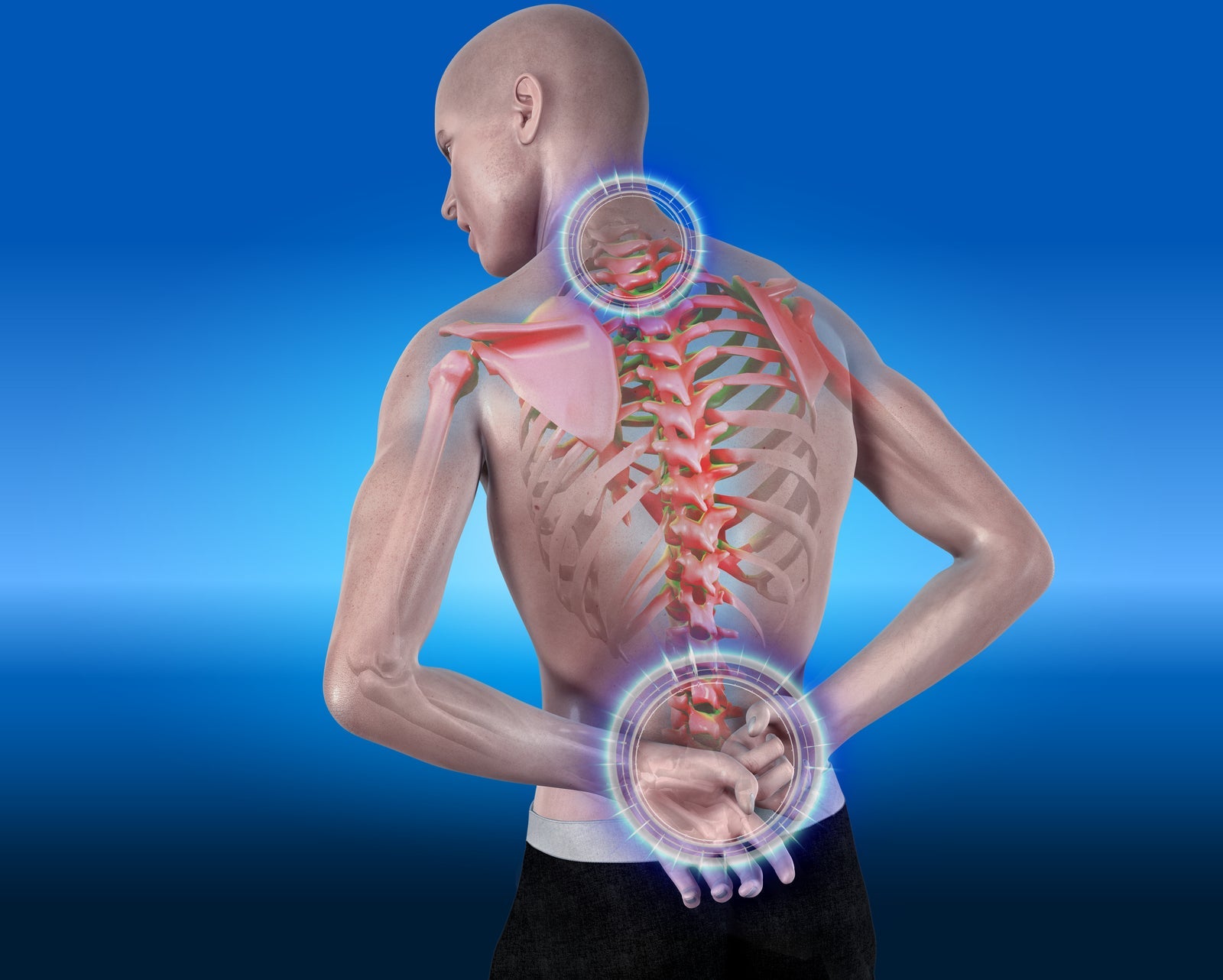 How to Fix Your Posture: The 5 Things You Need to Do - Sit Healthier