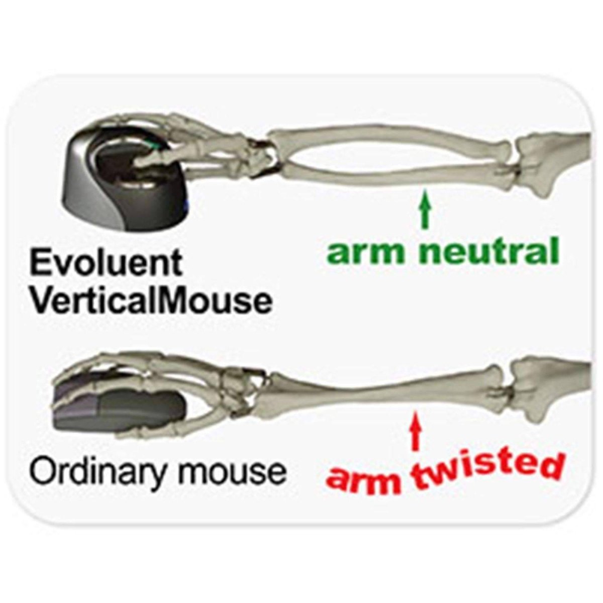Evoluent Vertical Ergonomic Mouse 4 Right; VM4R - Sit Healthier